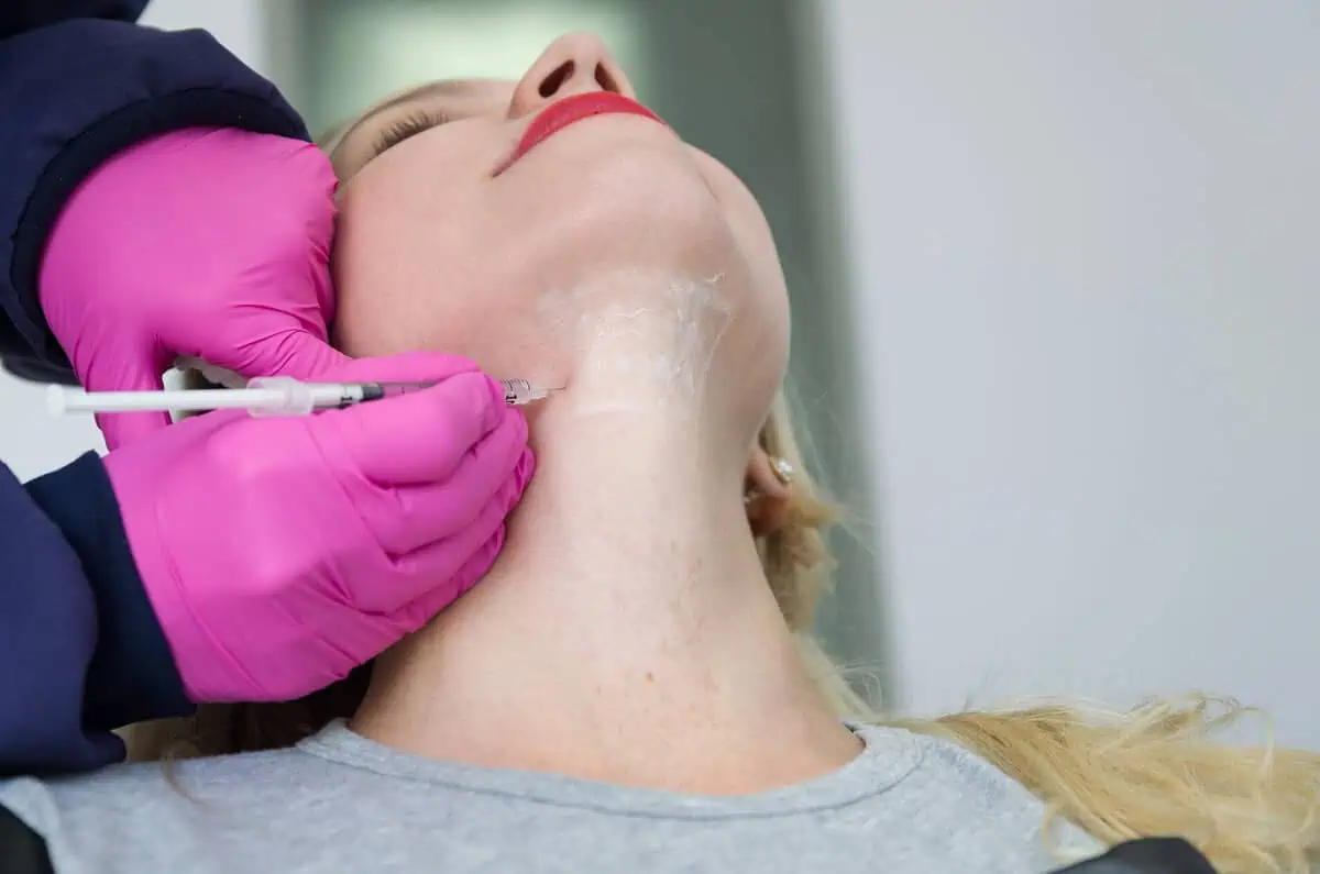 Kybella & Liposuction for double chin reduction Teo Aesthetics