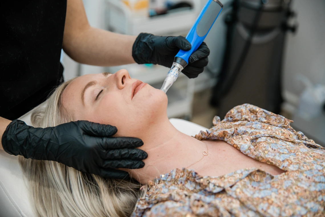 Microneedling with Skinpen in Denver, CO | Tēo Aesthetics